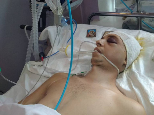 Проломили дрюченной череп: выяснились резонансные детали избиения ветерана АТО в Запорожье